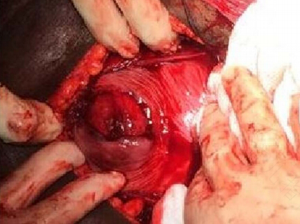 子宫里的血是怎么来得 子宫里的血是怎么来得