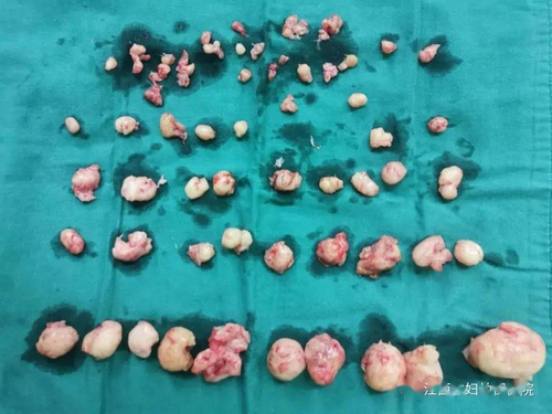 得了子宫癌有哪些症状?