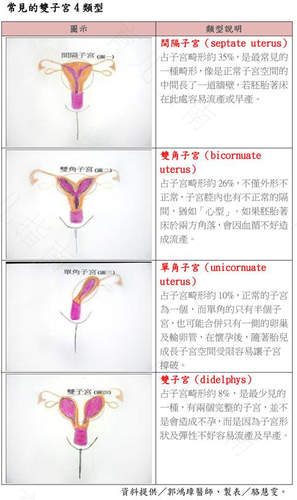 双子宫怎么治疗好一点