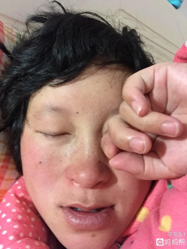 一直淌眼泪流鼻涕是怎么回事 一直淌眼泪流鼻涕是怎么回事