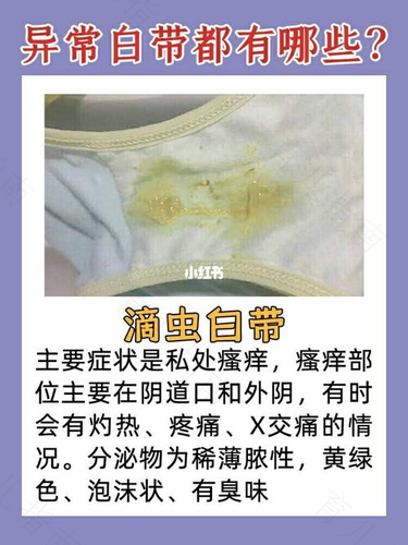白带果冻状凝胶发黄