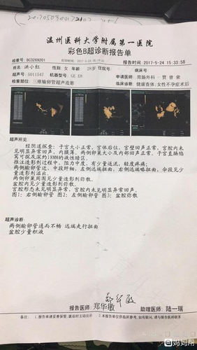 输卵管不通有啥症状吗 输卵管不通有啥症状吗