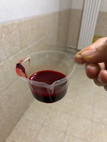 小肠火尿里有血怎么办 小肠火尿里有血怎么办