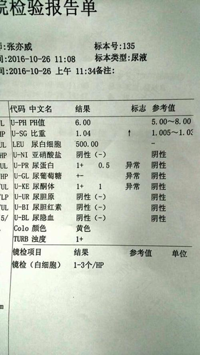 孕妇尿液中酮体高怎么回事 孕妇尿液中酮体高怎么回事