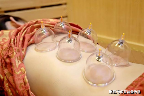 感冒发烧可以拔罐吗?