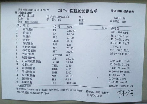 肝功怎么检查是抽血吗