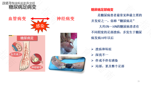 糖尿病外阴瘙痒的症状 糖尿病外阴瘙痒的症状