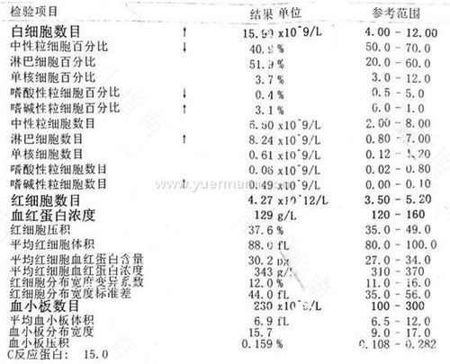 怎样看eb病毒dna化验单图片 怎样看eb病毒dna化验单图片
