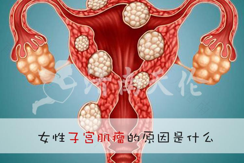 感觉子宫不舒服是什么原因 感觉子宫不舒服是什么原因