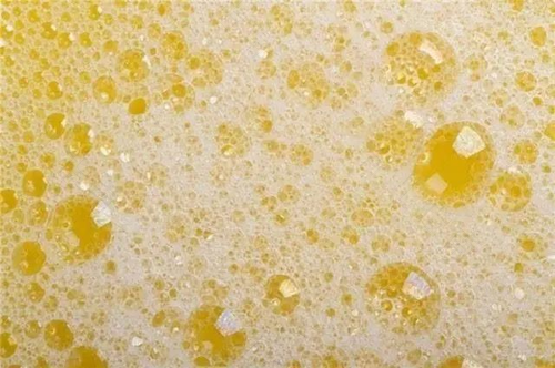 能引起大量蛋白尿的原因 能引起大量蛋白尿的原因