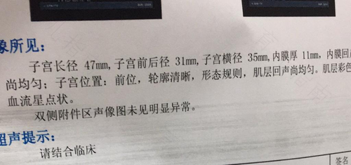 阴超能检查出子宫下垂吗 阴超能检查出子宫下垂吗