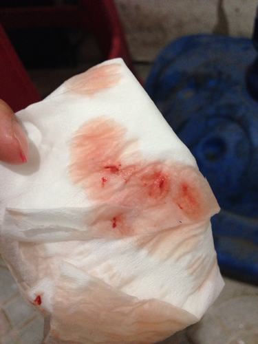 拉尿拉出血块是怎么回事女性 拉尿拉出血块是怎么回事女性