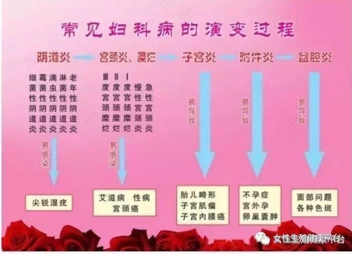 慢性盆腔炎和宫颈炎的区别 慢性盆腔炎和宫颈炎的区别