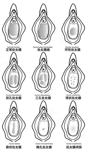处女会得宫颈疾病吗 处女会得宫颈疾病吗