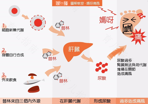 高尿酸血症有哪些症状表现