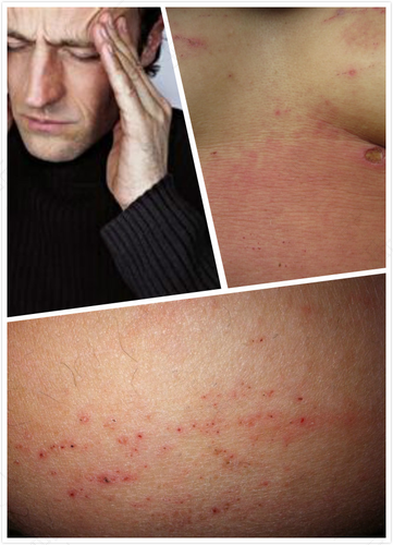 感染hiv的前期症状有哪些