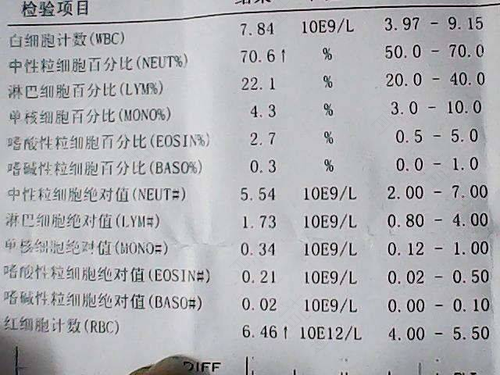 血常规正常地贫的概率 血常规正常地贫的概率