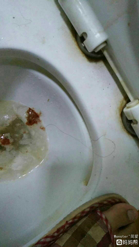 喝醉酒一直吐胆汁怎么办 喝醉酒一直吐胆汁怎么办