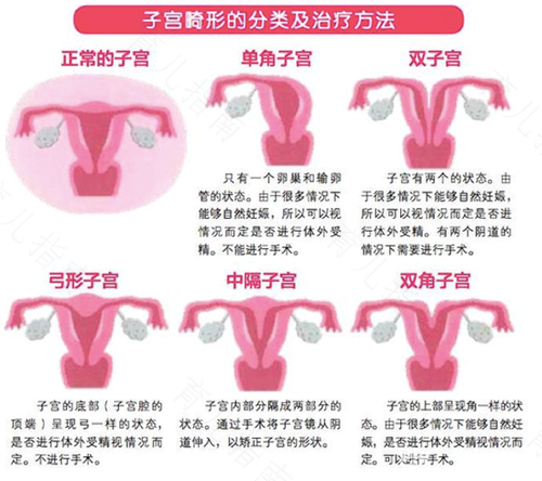 什么情况下会导致子宫收缩 什么情况下会导致子宫收缩