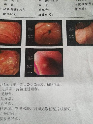 食道堵塞怎么办?