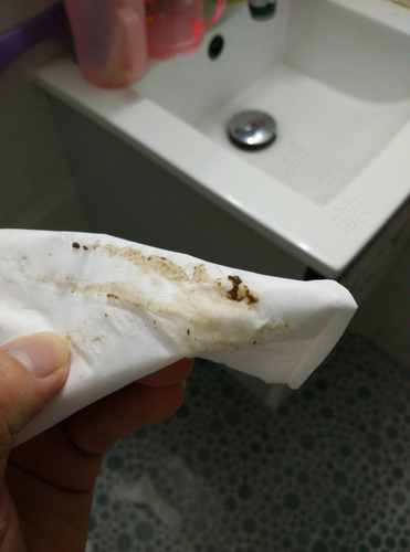 月经量少颜色咖啡色是什么原因