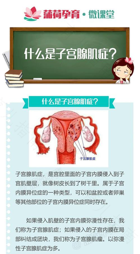 子宫腺肌症是什么病,严重吗 子宫腺肌症是什么病,严重吗