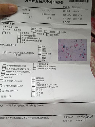 宫颈病变tct能检查出来吗
