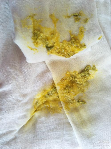 肚子剧烈疼痛拉稀是怎么回事