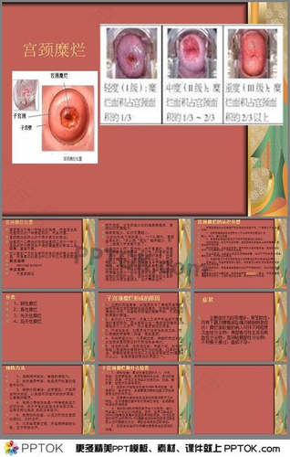 怀孕宫颈变短的原因 怀孕宫颈变短的原因