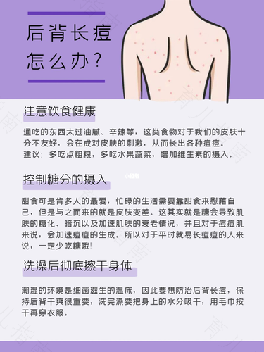 背部长痘痘怎么治疗中医 背部长痘痘怎么治疗中医