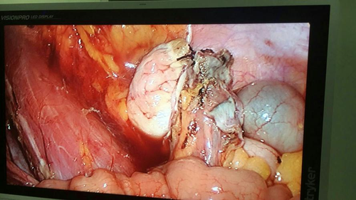 宫颈切除了还会再长吗 宫颈切除了还会再长吗