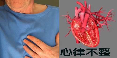 心脏心律不齐怎么办有停跳心侓 心脏心律不齐怎么办有停跳心侓