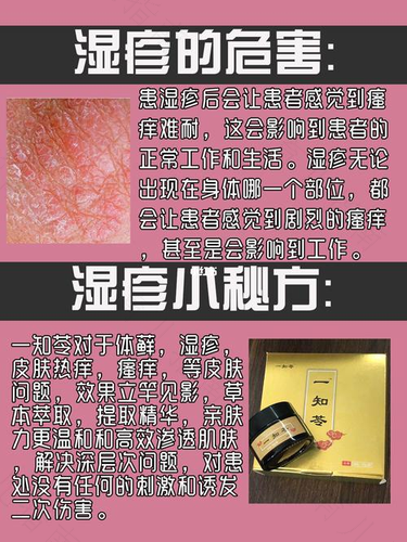 如何治疗慢性湿疹最有效