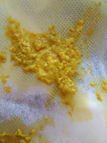 怎么治拉肚子最快最有效的 怎么治拉肚子最快最有效的