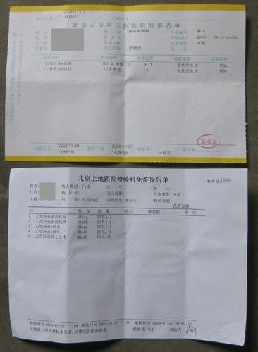 怎么判断自己有没有乙肝病毒