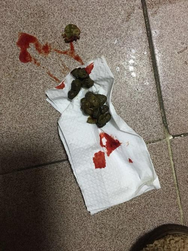 便秘拉屎出血怎么回事 便秘拉屎出血怎么回事