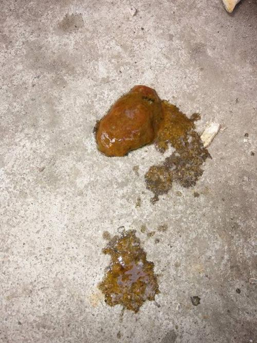 拉肚子后尿血什么原因 拉肚子后尿血什么原因