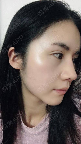 鼻子一直淌清水怎么回事 鼻子一直淌清水怎么回事