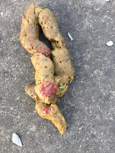 大便后出现鲜血怎么治疗