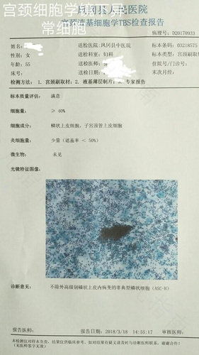 宫颈tct是检查什么的 宫颈tct是检查什么的