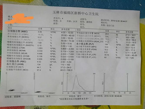 红斑狼疮怎么确诊 红斑狼疮怎么确诊