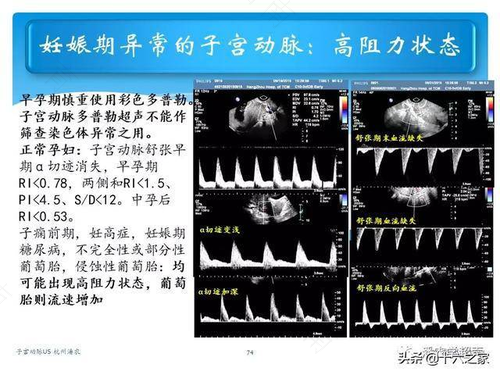 双侧子宫动脉阻力增高能医治好吗 双侧子宫动脉阻力增高能医治好吗