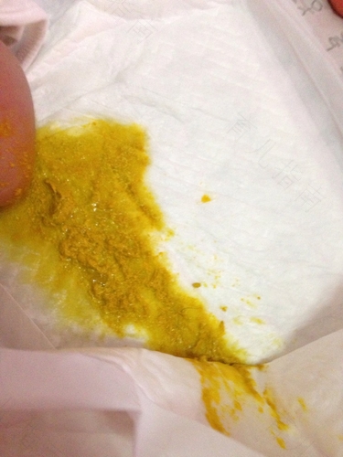 大人反反复复腹泻一个月 大人反反复复腹泻一个月