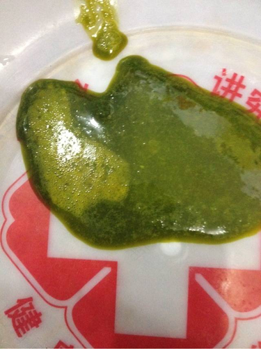 婴儿绿色大便怎么回事 婴儿绿色大便怎么回事