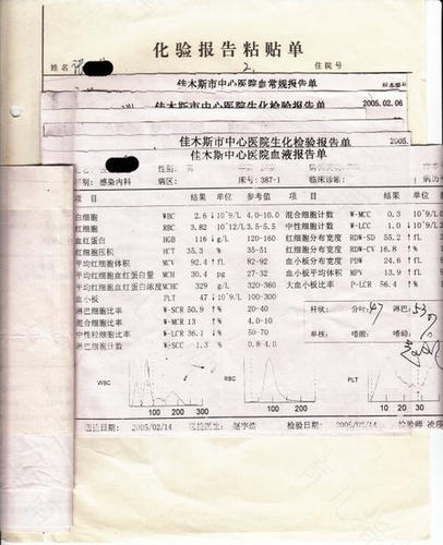 乙肝轻度肝硬化严重吗 乙肝轻度肝硬化严重吗