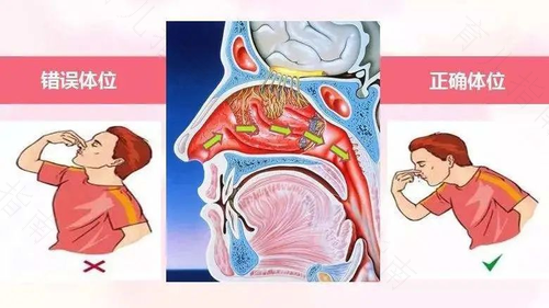 小孩发烧流鼻血正常吗 小孩发烧流鼻血正常吗