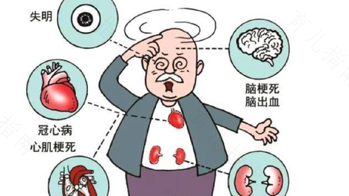 糖尿病人有高血压怎么办 糖尿病人有高血压怎么办