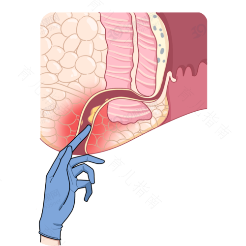 最近肛门周围疼是怎么回事 最近肛门周围疼是怎么回事