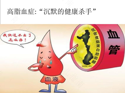 怎么治疗高血脂好 怎么治疗高血脂好