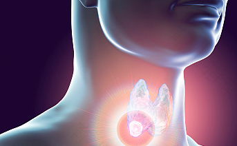 有甲状腺结节该怎么办 有甲状腺结节该怎么办